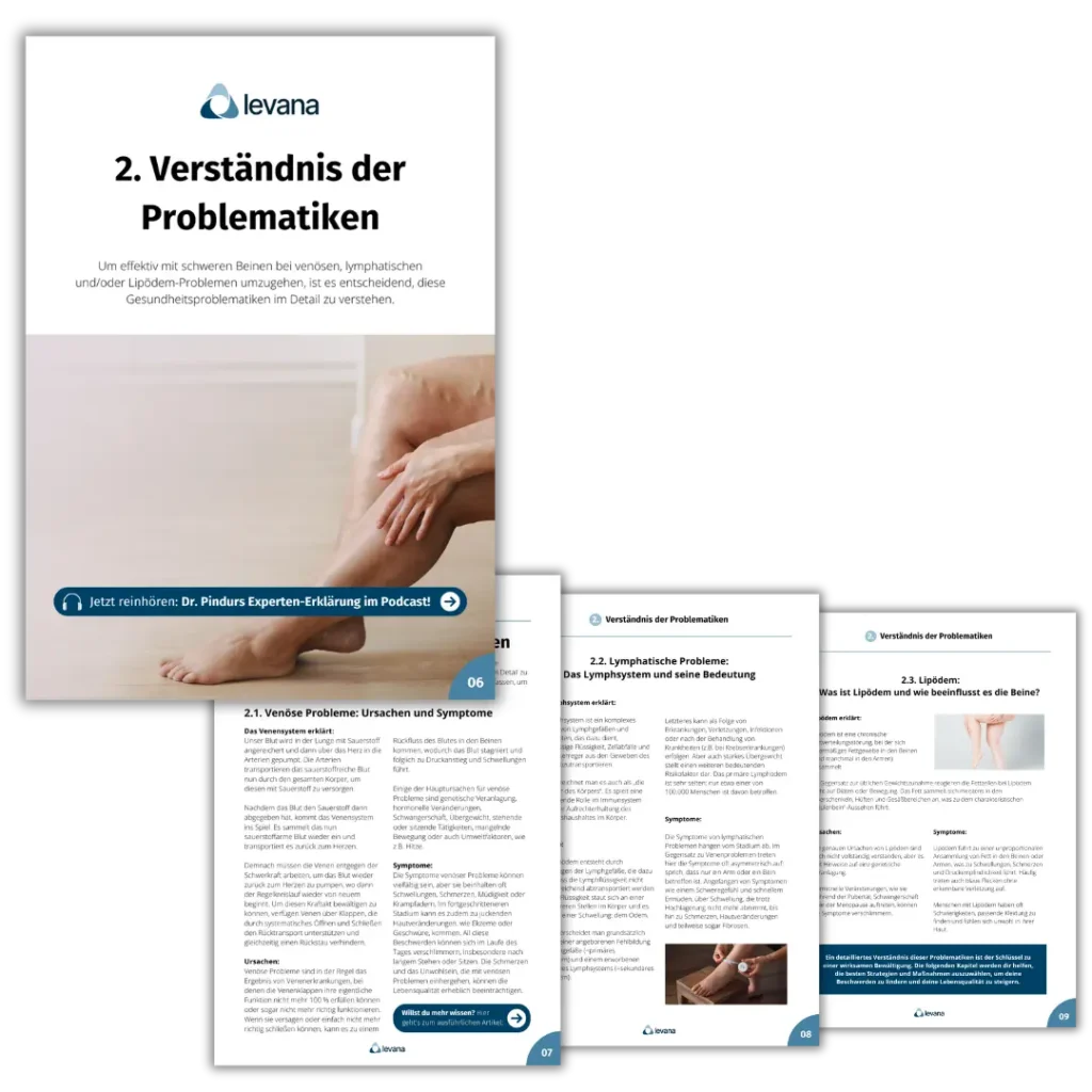 Mockup von 4 Seiten aus unserem Ratgeber mit Hintergrundwissen zum Thema schwere Beine.